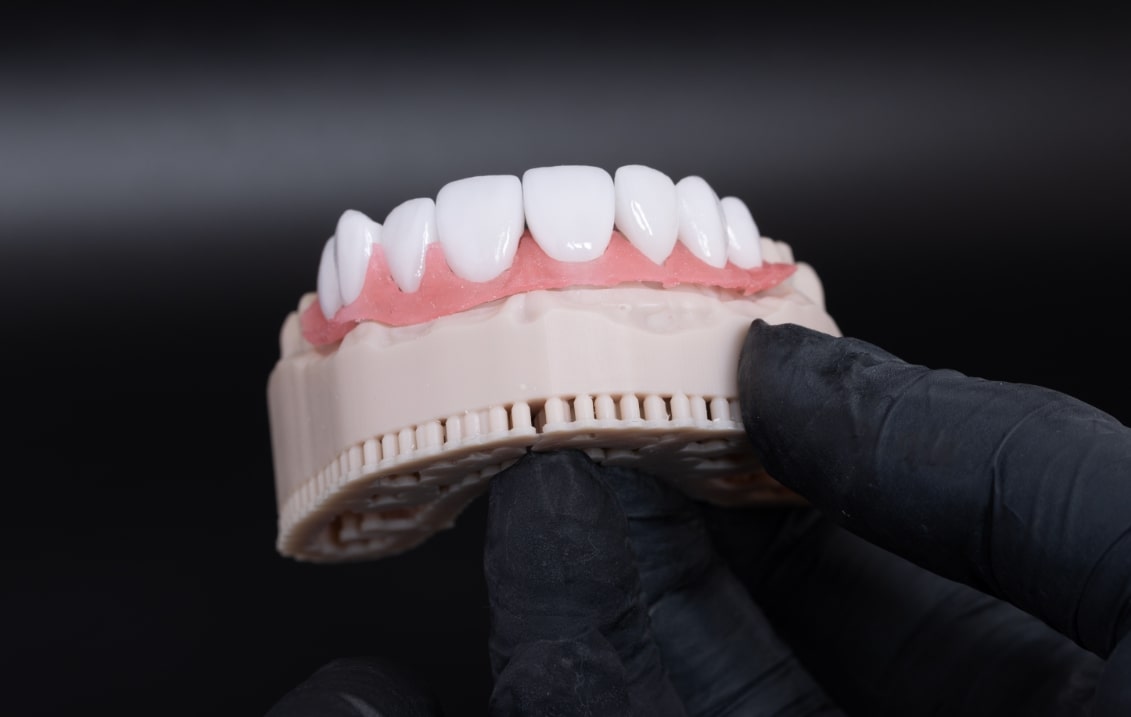 Die untere Zahnreihe eines künstliches Gebisses 