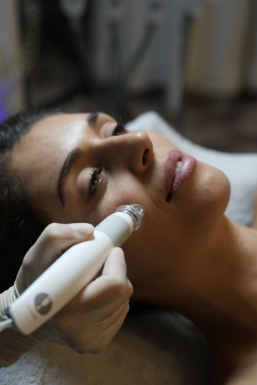 Radiofrequenz-Microneedling-500x750.jpg 